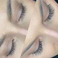 Side-by-side comparison of a woman's eyelashes before and after enhancement, showcasing significant length and volume improvement.