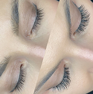 Side-by-side comparison of a woman's eyelashes before and after enhancement, showcasing significant length and volume improvement.