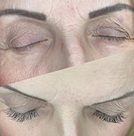 Close-up of a woman's eyes showcasing the transformation before and after eyelash extensions, highlighting fuller lashes.