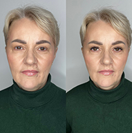 Side-by-side comparison of an older woman wearing a green turtleneck, showing subtle makeup differences, particularly around the eyes.